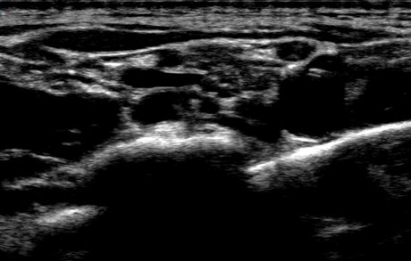 kacenna erotic model image