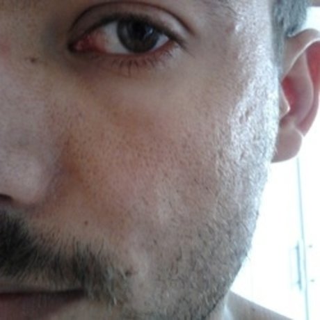 Edson Silva star pretty picture