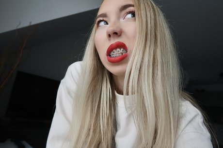 Kate in Braces pornstar nice pictures