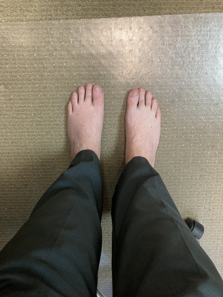 Baldguy star nudes gallery