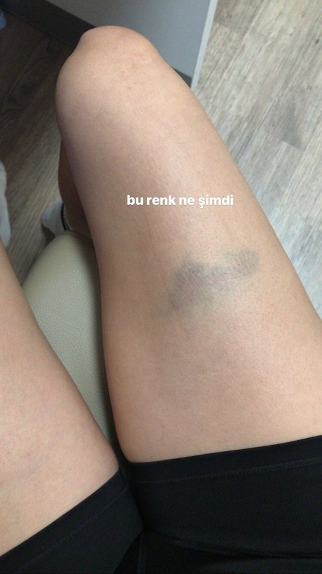 chubby emo onlyfans hot nude gallery