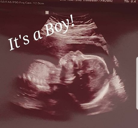 Stephanie Fox star nudes photos