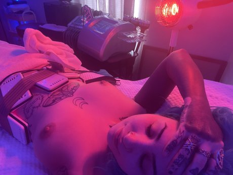 Birth defect high quality actress picture