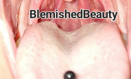blemishedbeauty hot star photos