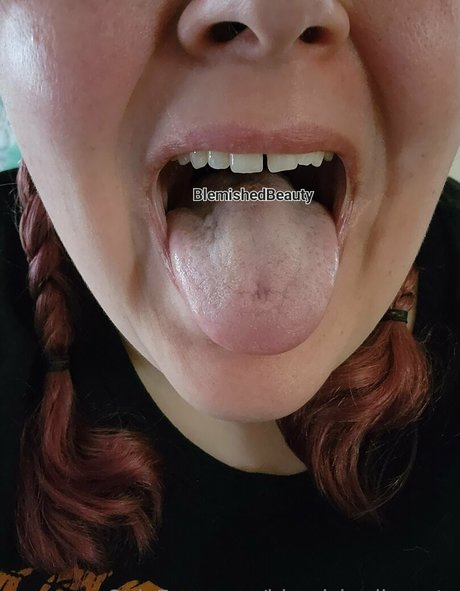 blemishedbeauty model sex photos