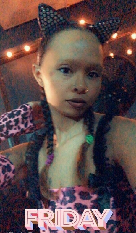 disabled onlyfans sexy photos