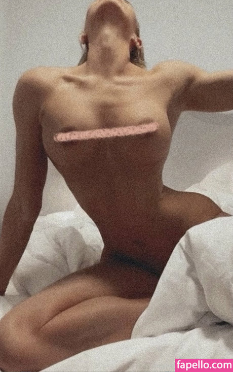 La Ostergren model best img