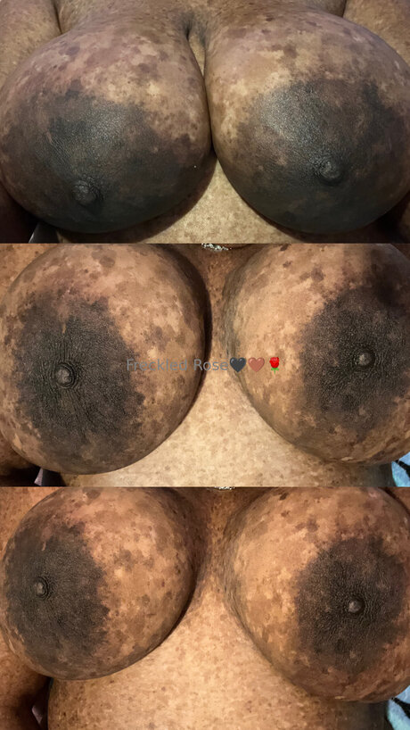 Freckledfantasy5 Profile