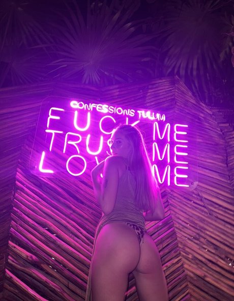 Zoella McKay Profile