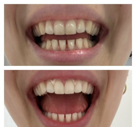 zoenafree model hd image