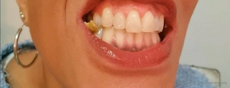 teomasole model hd picture