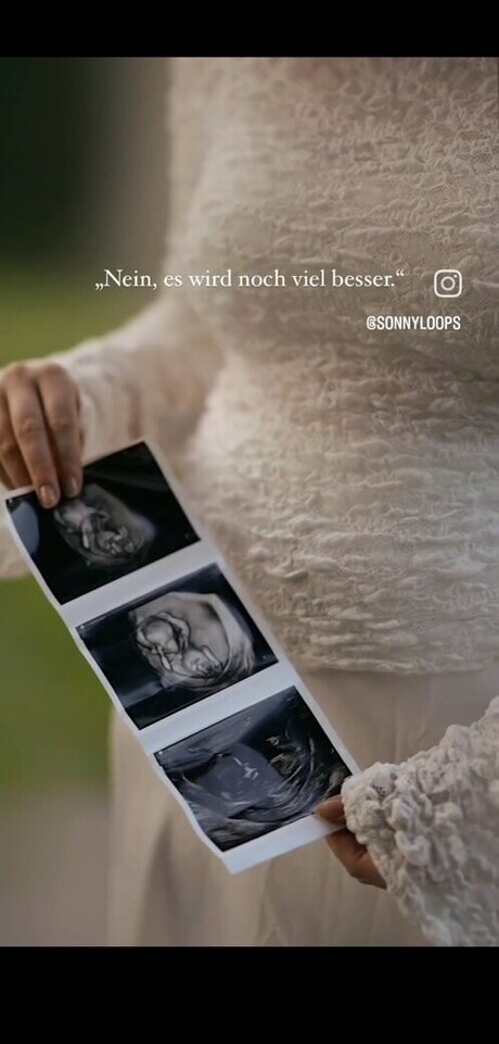 Sonny Loops sex actress images