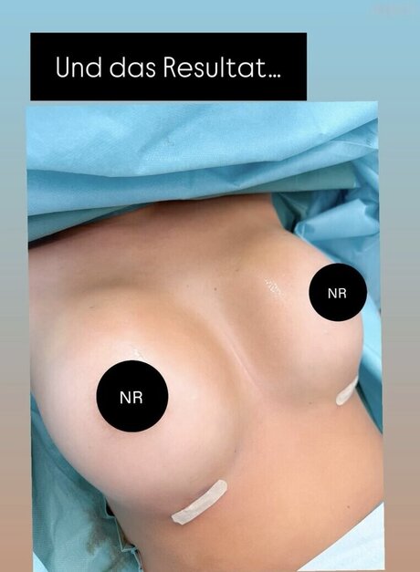 flat onlyfans best picture