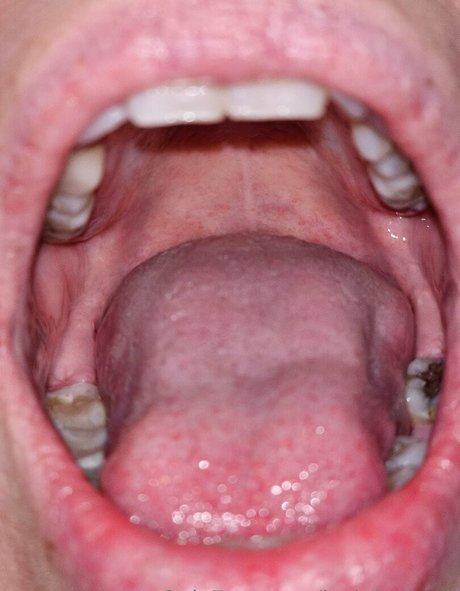 puffy nipples onlyfans sexy nude gallery