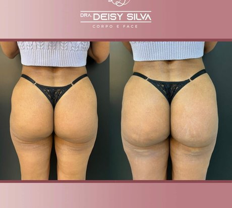 Dominik Bertoluci perfect actress galleries