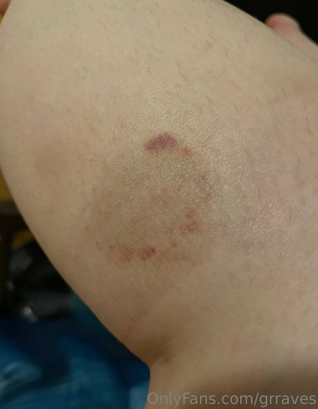 grraves model best archive