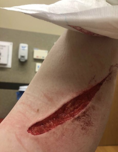 lewdhyena exclusive star pic