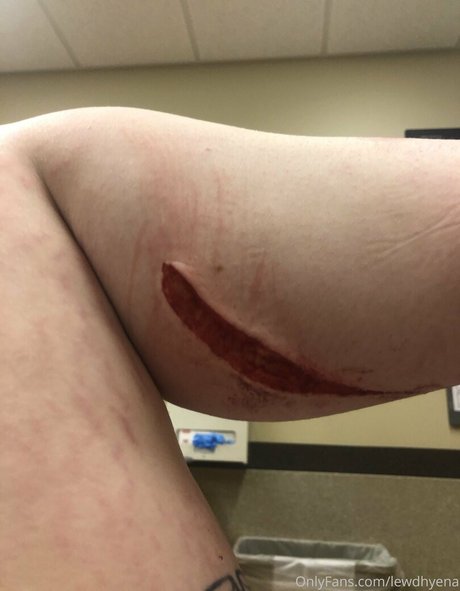 lewdhyena model free gallery