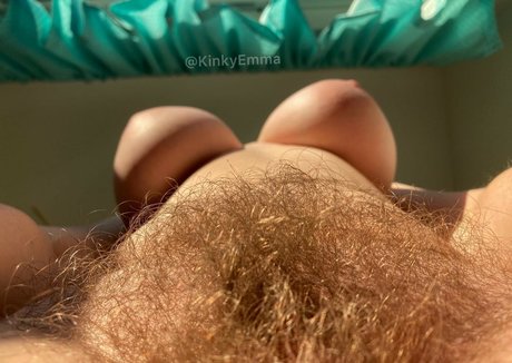 kinkyemma art star pic