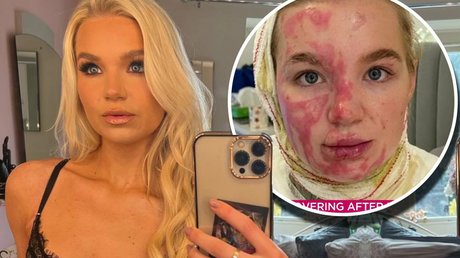 Abbie Quinnen free model photo