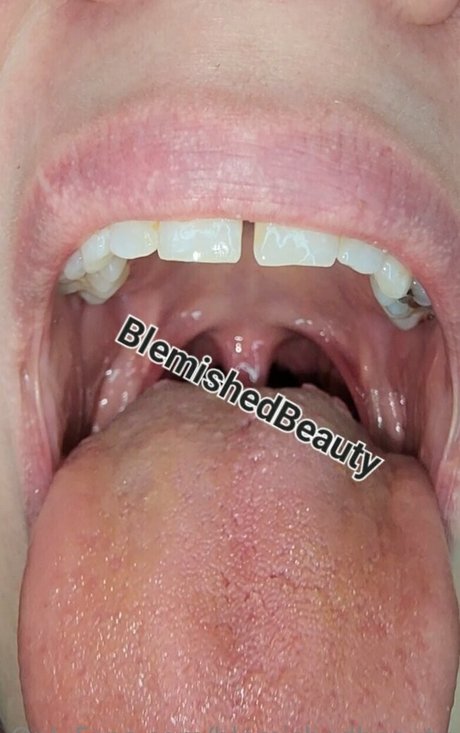 blemishedbeauty model adult picture