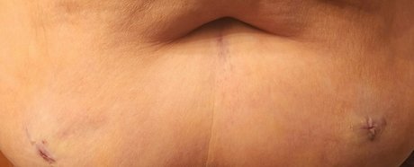 blemishedbeauty pornographic star galleries