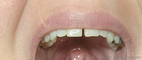 blemishedbeauty star hd gallery