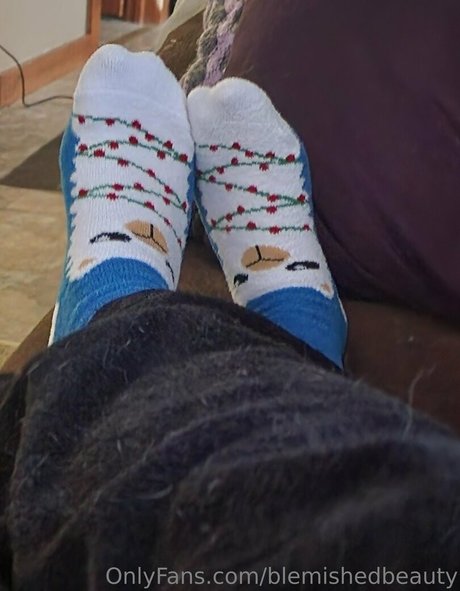 blemishedbeauty star high quality galleries