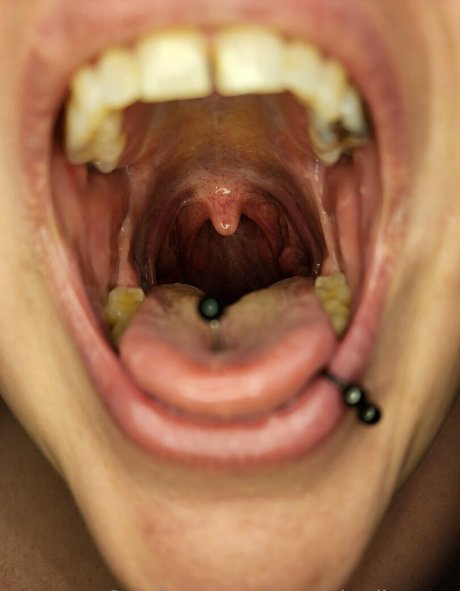 blemishedbeauty hot star photo