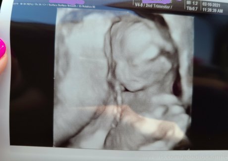 perfect feet onlyfans exclusive pictures