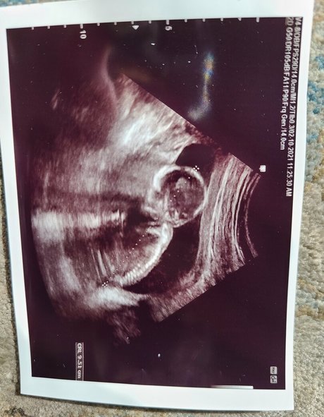 goodluckanne pretty model archive