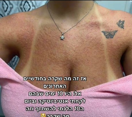 bikini ginger onlyfans free naked picture