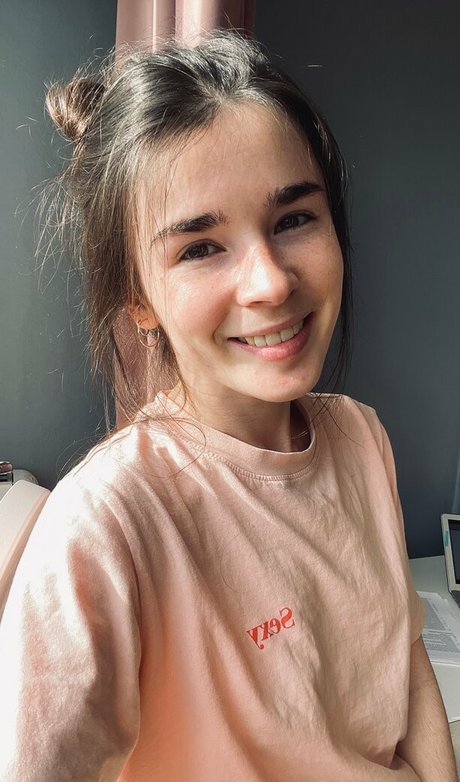 o dent star high quality picture