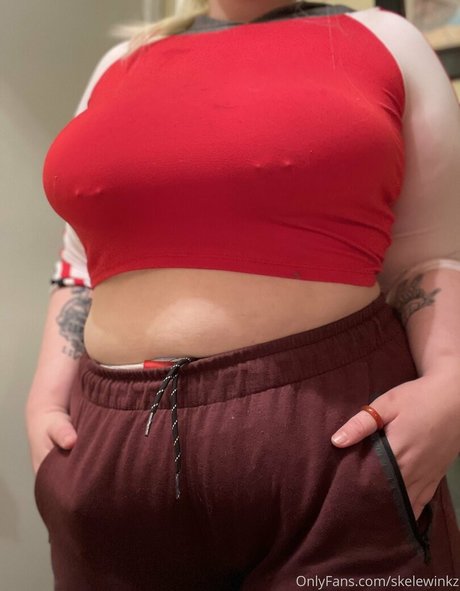 skelewinkz sex actress photo