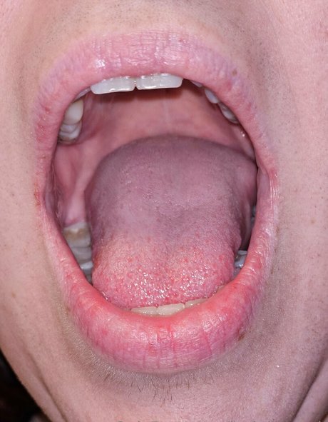 jackdaspeck freie porno bilder