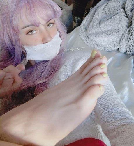 achilles heelz exklusive fotos