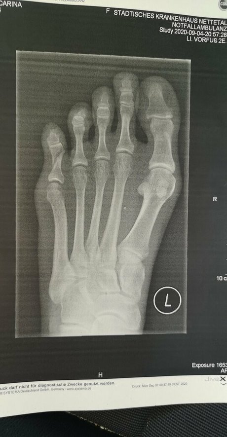 birki heaven kunst sexy fotos