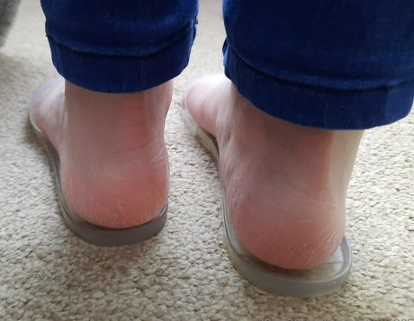 homefortoes beste akt galerie