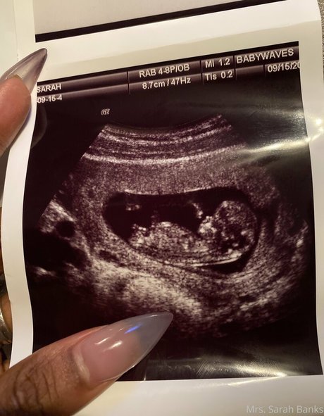 nackte asiatische onlyfans hd erwachsene bilder