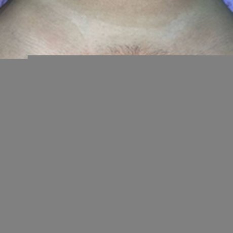 babygirl 18bg nacktheit top bild