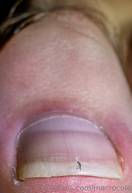 macrocole model hd foto