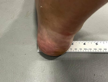 amazonlynn erwachsene sex galerien