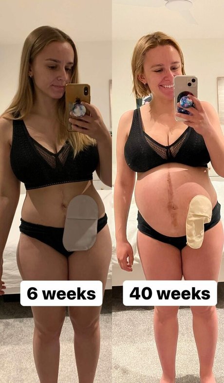 Hannah Witton schöne sexy archiv