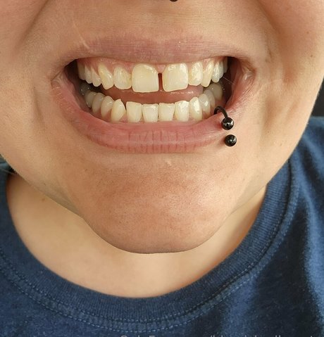 blemishedbeauty hd freie galerien