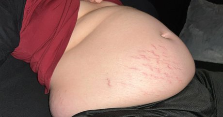 skinny twiggy nackt freie archiv