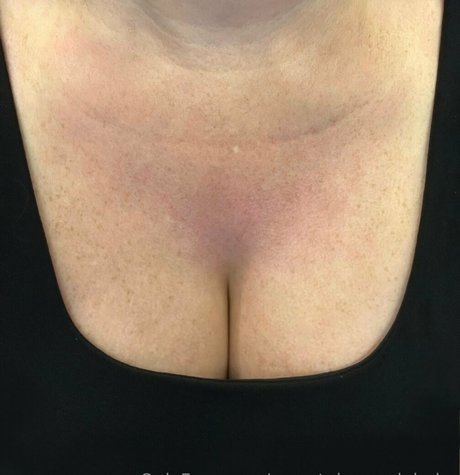 secretpineapplebabe pornographische galerien