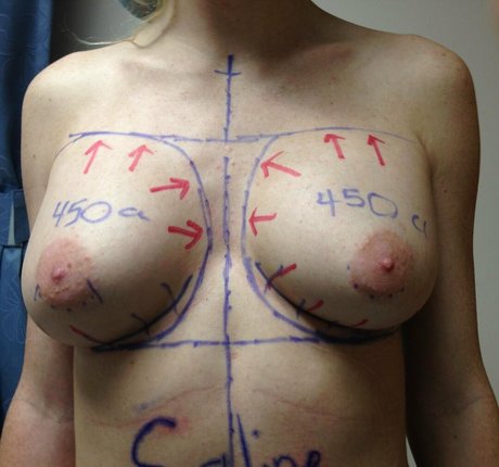 cameltoe onlyfans top erwachsene fotos