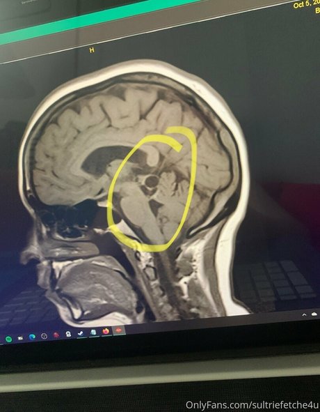 sultriefetche4u top nackten bilder